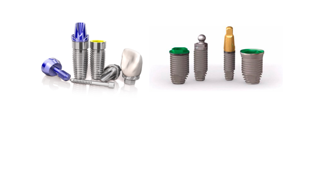 Виды имплантов для зубов